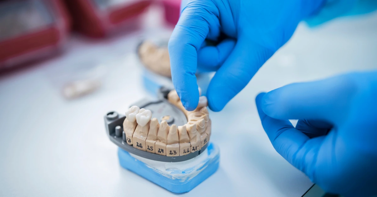 what is a dental bridge